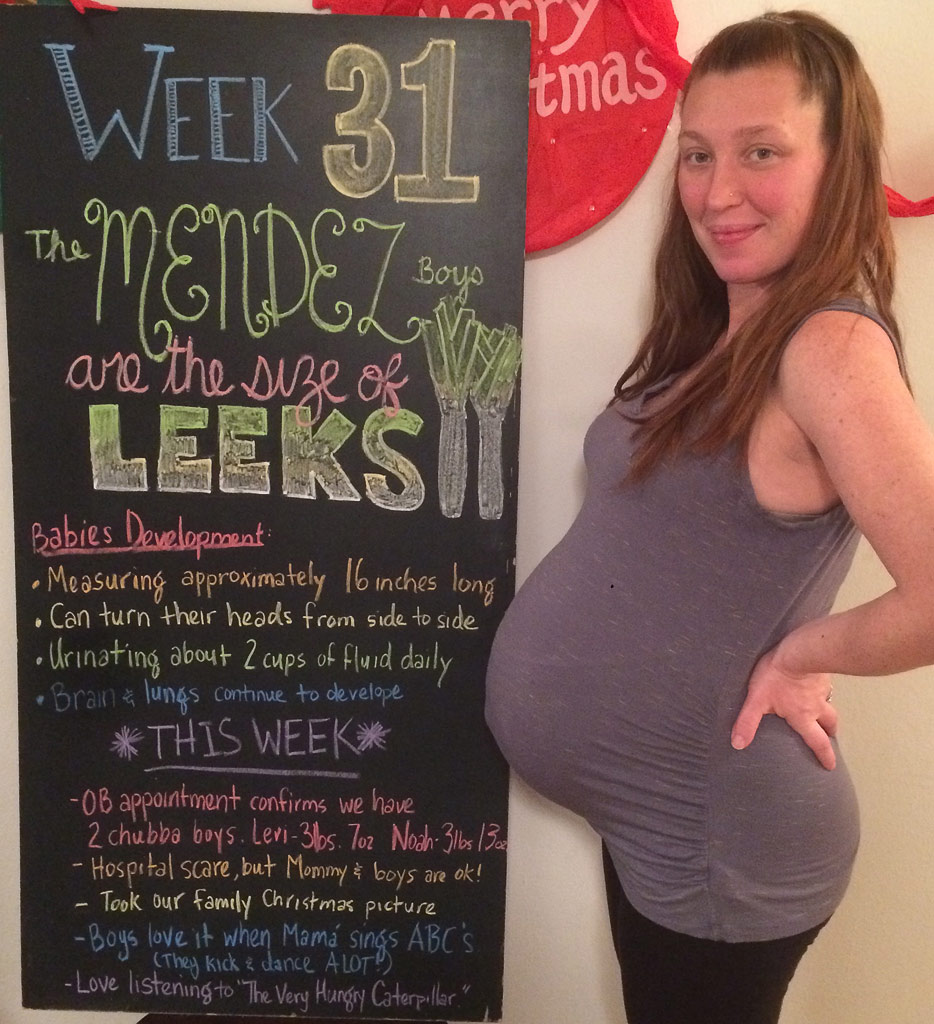 31 week twin belly